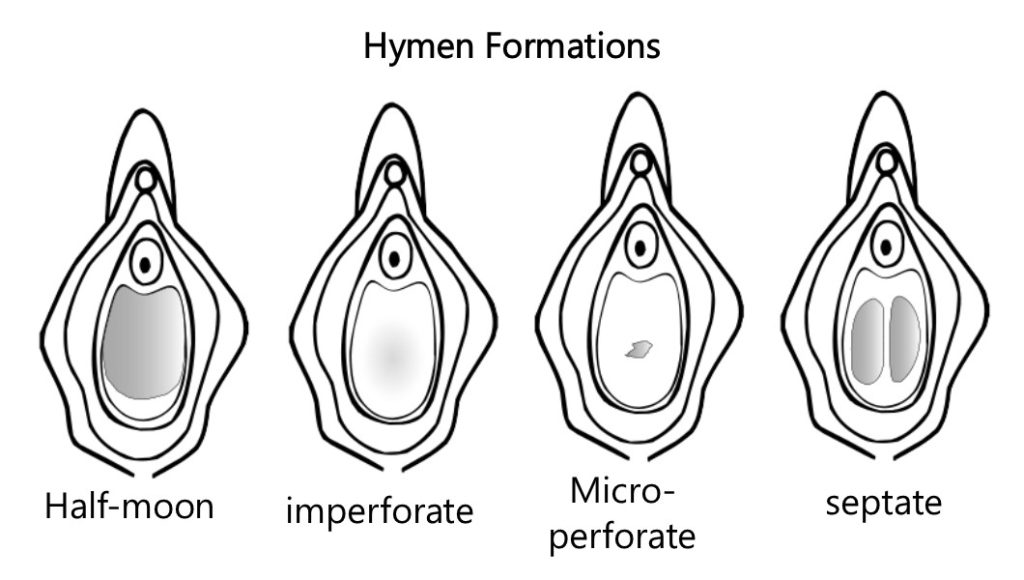 Type Of Vagina Shapes - Minetransport